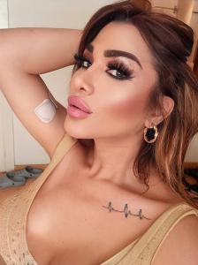 631112662: Transexual en Madrid